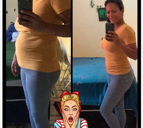 antes e depois