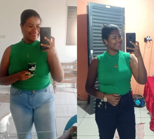 antes e depois