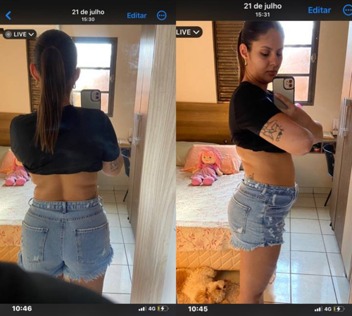 antes e depois