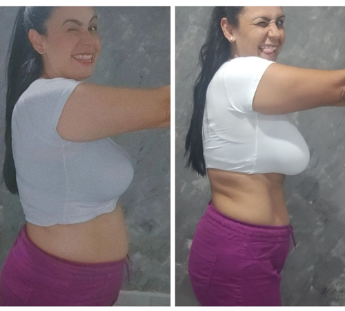 antes e depois